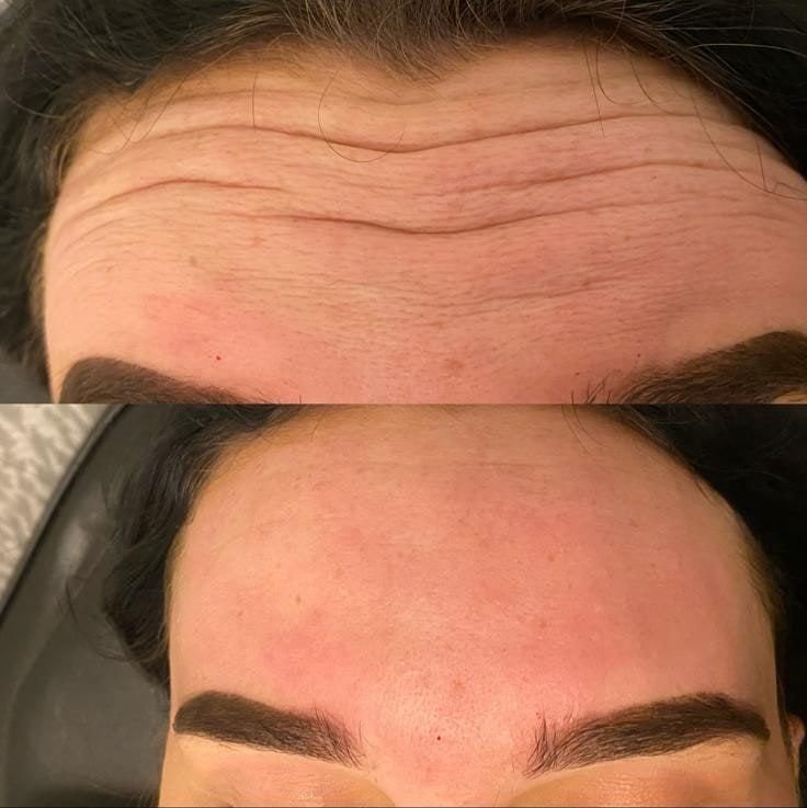 Advanced tox treatments